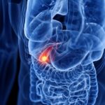 7 Things to Know About LAT1 Inhibitor Nanvuranlat (JPH203)