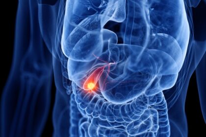 7 Things to Know About LAT1 Inhibitor Nanvuranlat (JPH203)